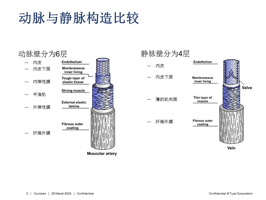 DVT病理基础及防治(患者教育)解读课件.ppt_第2页