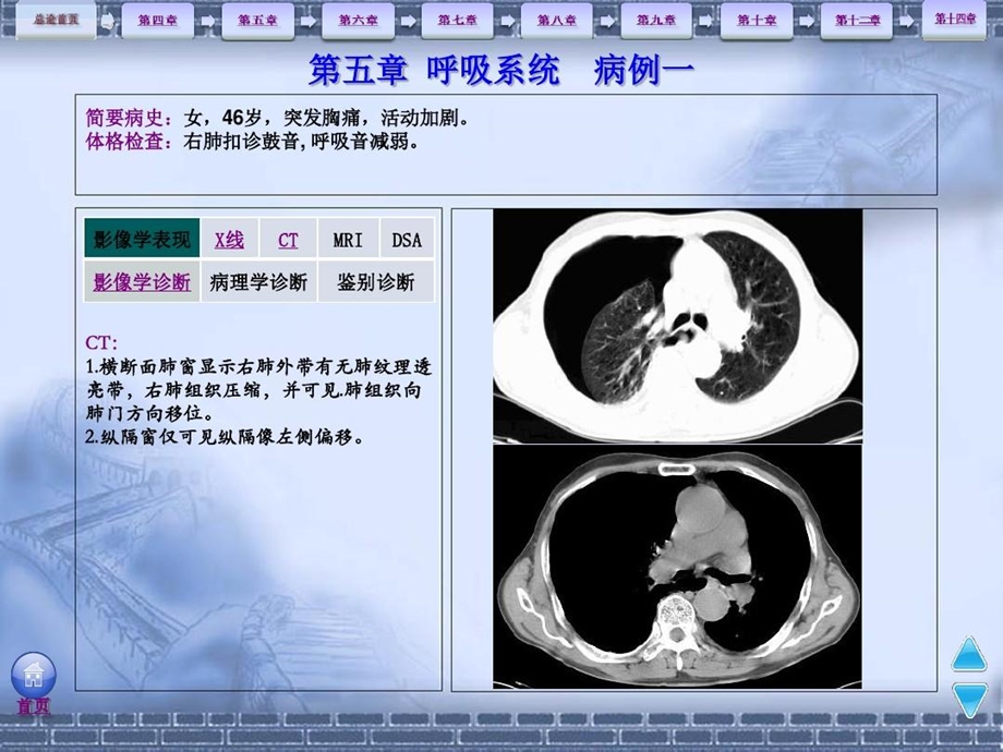 《影像学》病例分析呼吸系统解读课件.ppt_第3页