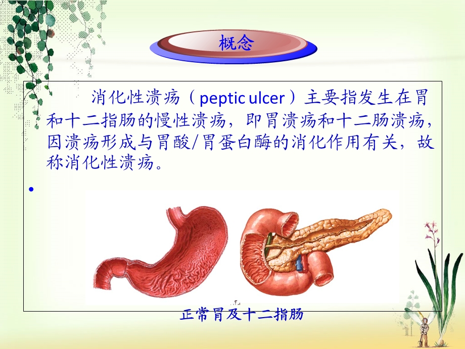 一份消化性溃疡胃镜下表现及护理PPT课件.ppt_第3页