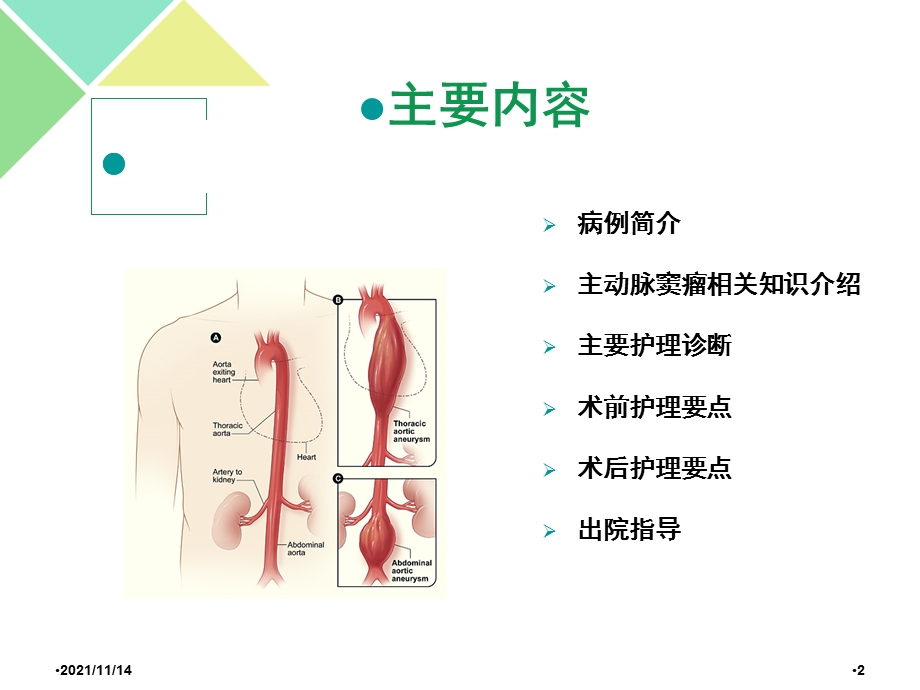 主动脉夹层动脉瘤围手术期教学查房课件.ppt_第2页