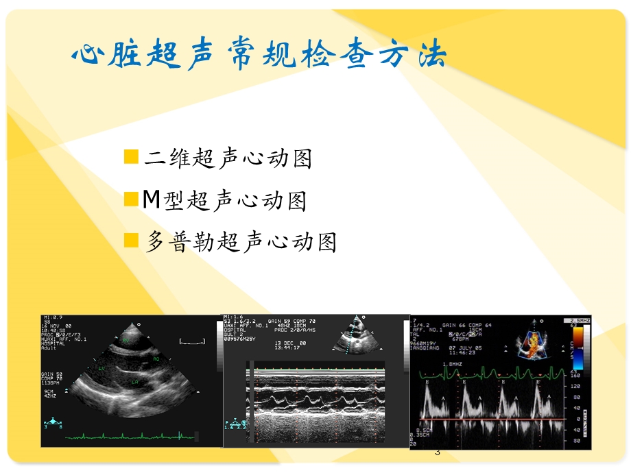 怎么解读超声心动图报告课件.ppt_第3页