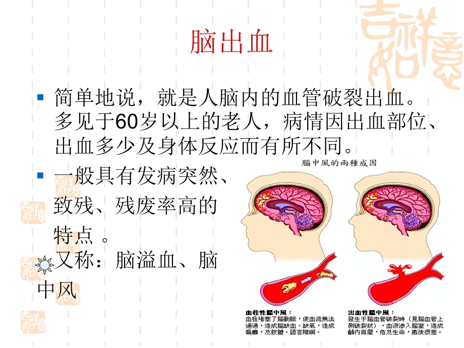 预防脑出血12招 课件.ppt_第2页