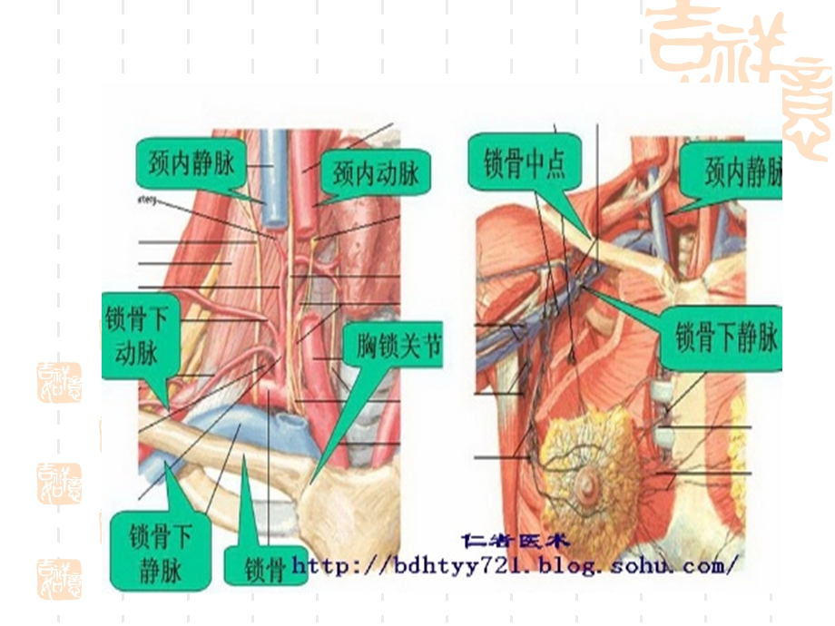 降低中心静脉穿刺ppt课件.ppt_第3页