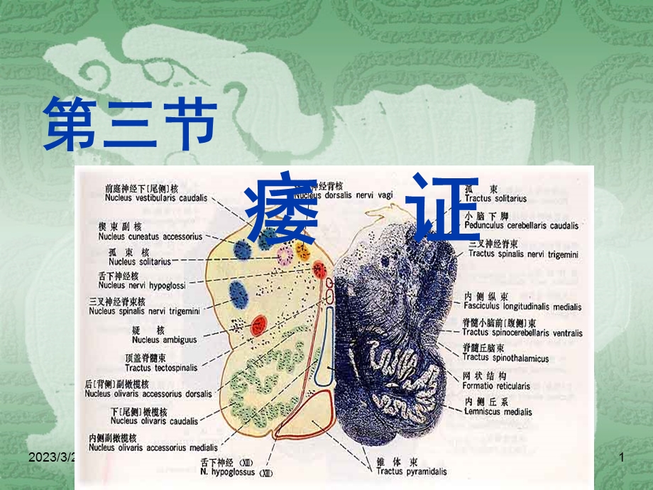 中医内科学ppt课件-痿证.ppt_第1页