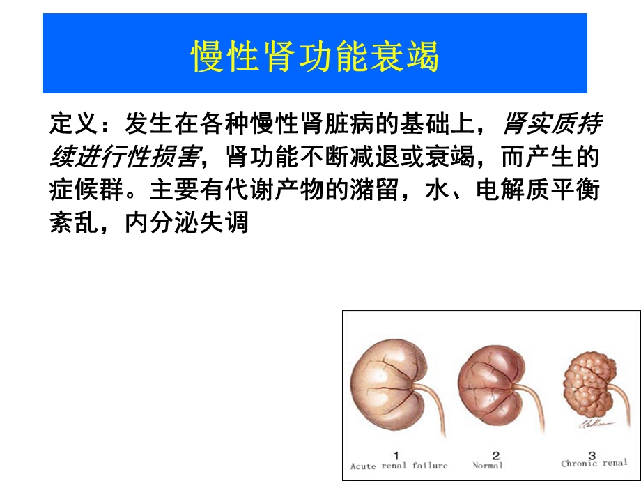 慢性肾功能衰竭_课件.ppt_第3页