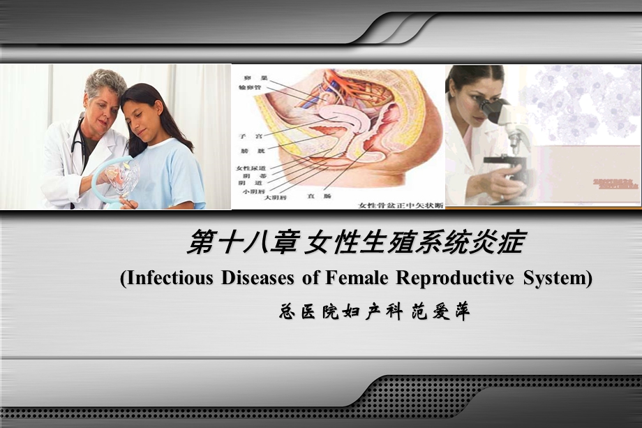 第十八章 女性生殖系统炎症课件.ppt_第1页