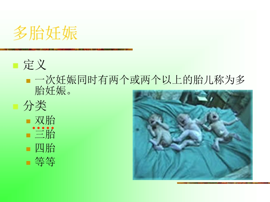 妊娠期并发症妇女的护理--双胎妊娠课件.ppt_第2页