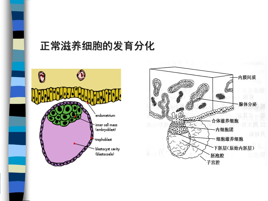 妊娠滋养细胞疾病课件ppt.ppt_第2页