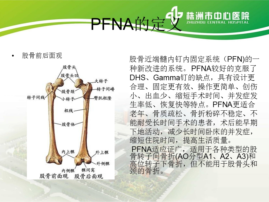 PFNA内固定术护理查房课件.ppt_第2页