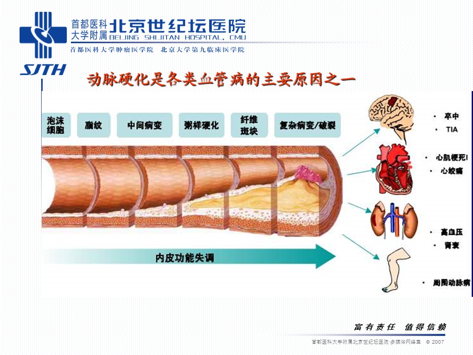 他汀抗动脉粥样硬化在脑血管病防治中的作用课件.ppt_第3页