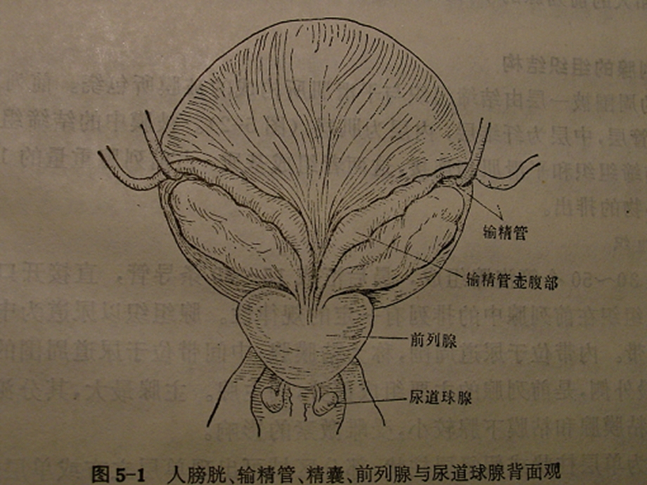 良性前列腺增生症(BPH)课件.ppt_第2页