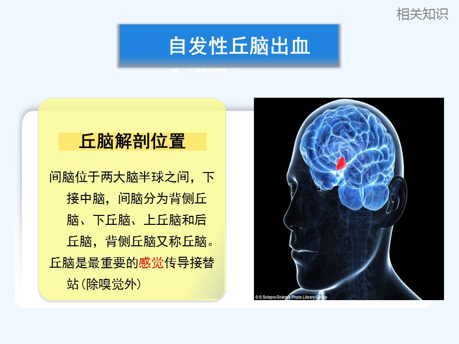 丘脑出血个案查房课件.ppt_第2页