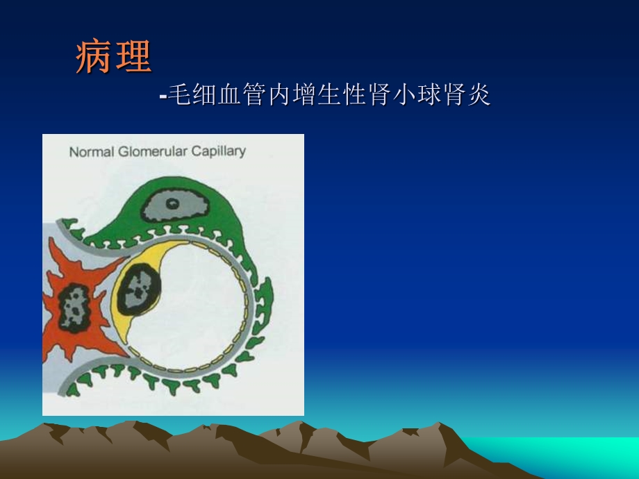 急性肾小球肾炎 acute glomerulonephritis课件.ppt_第3页