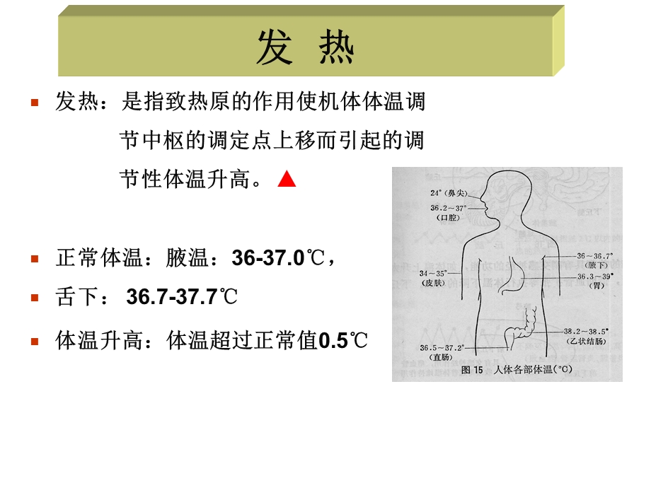 发热医学ppt课件.ppt_第1页