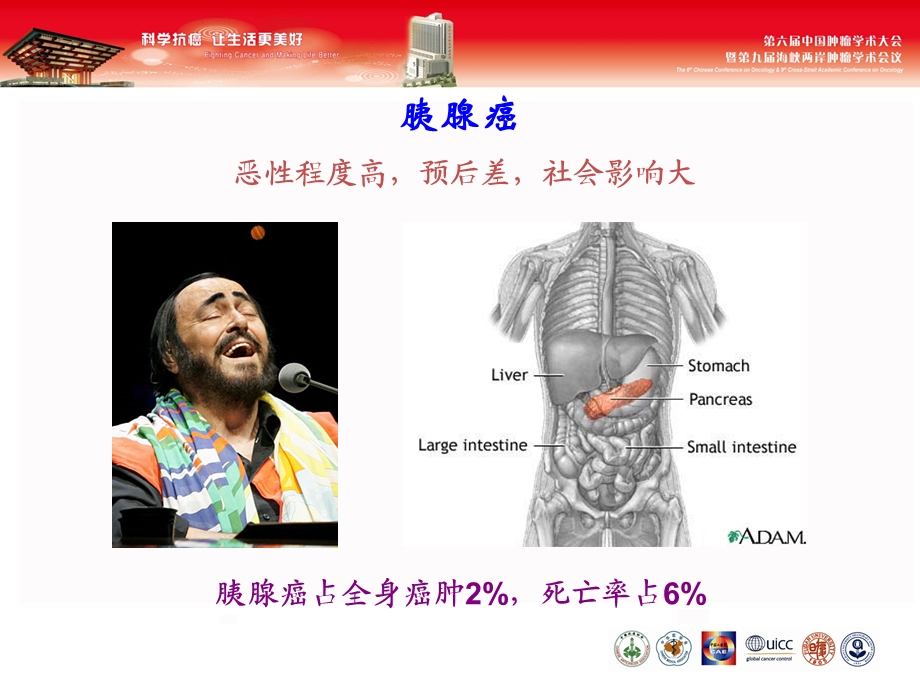 胰腺癌的诊治现状及展望课件.ppt_第2页