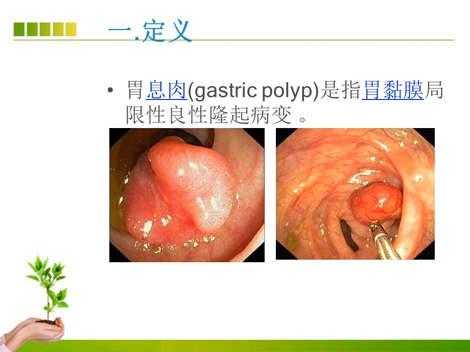 胃息肉内镜手术的治疗及护理课件.ppt_第3页