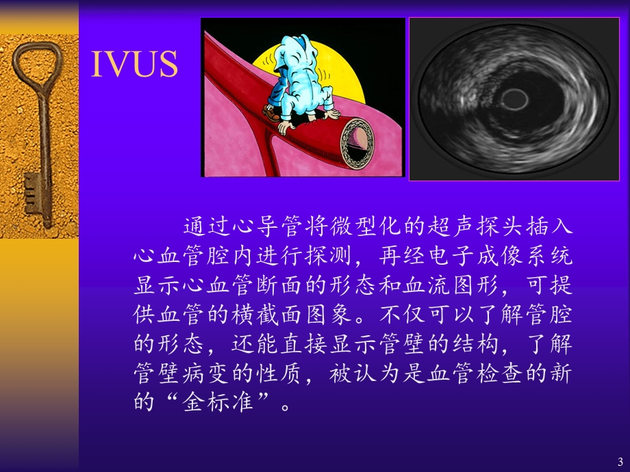 血管内超声IVUS的相关资料医学课件.ppt_第3页