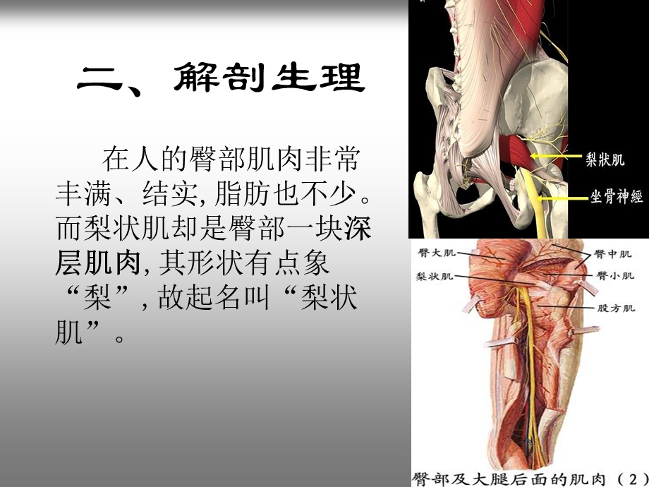 梨状肌综合征方案课件.ppt_第3页