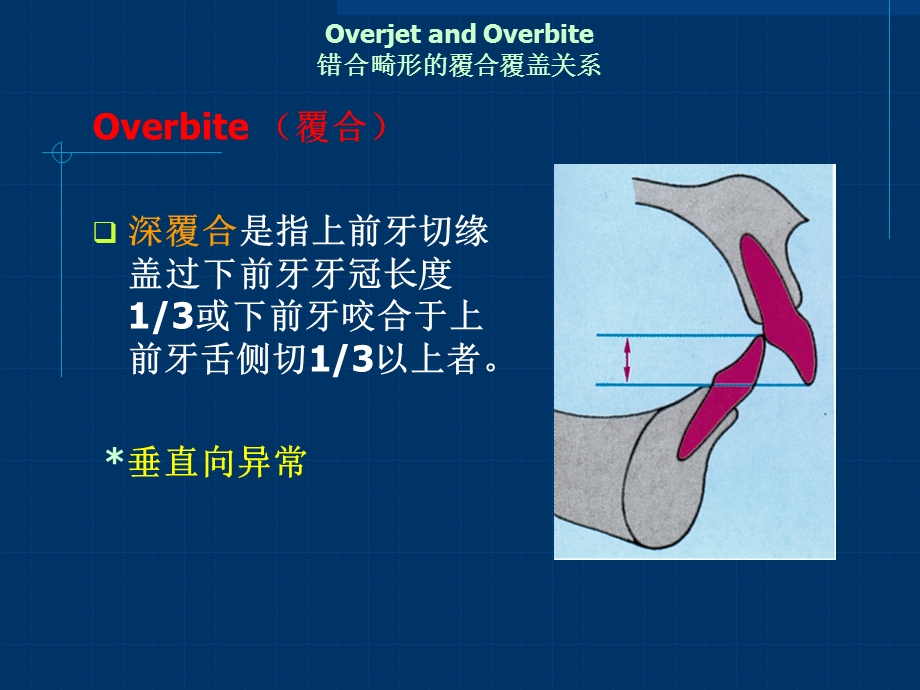 深覆牙合的矫治课件.ppt_第2页