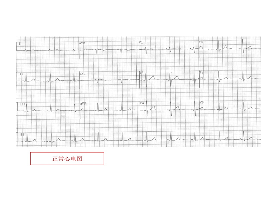 规培考试的资料心电图课件.ppt_第1页