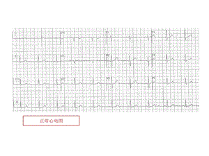 规培考试的资料心电图课件.ppt