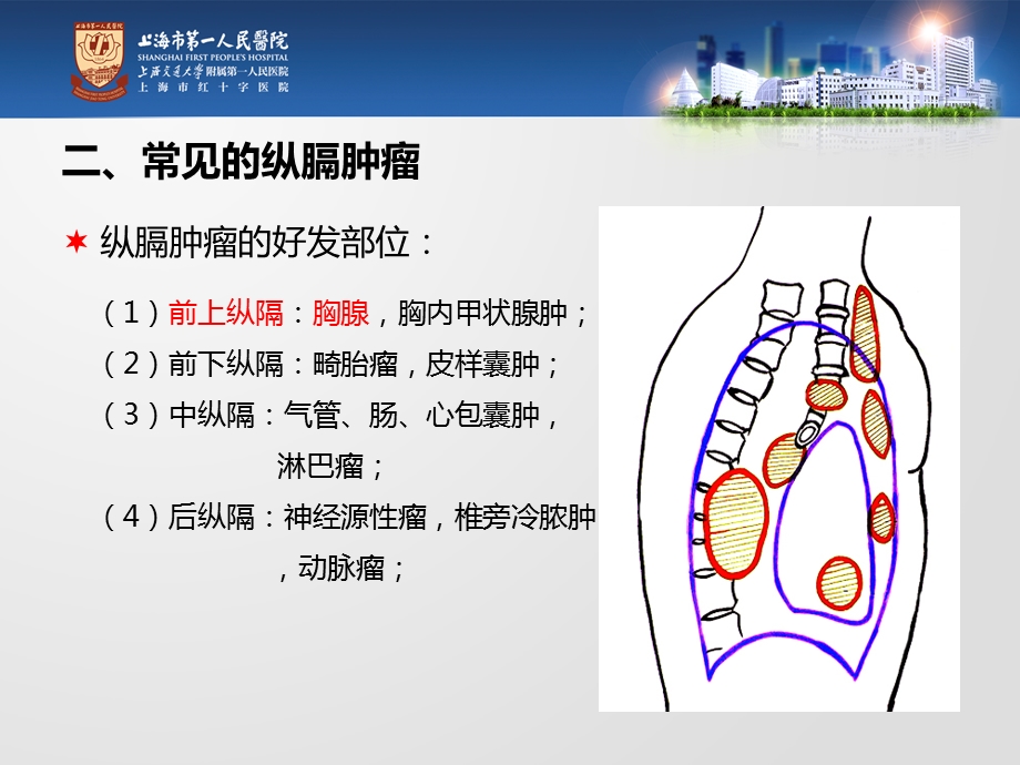 纵膈肿瘤临床表现及围手术期护理课件.ppt_第3页