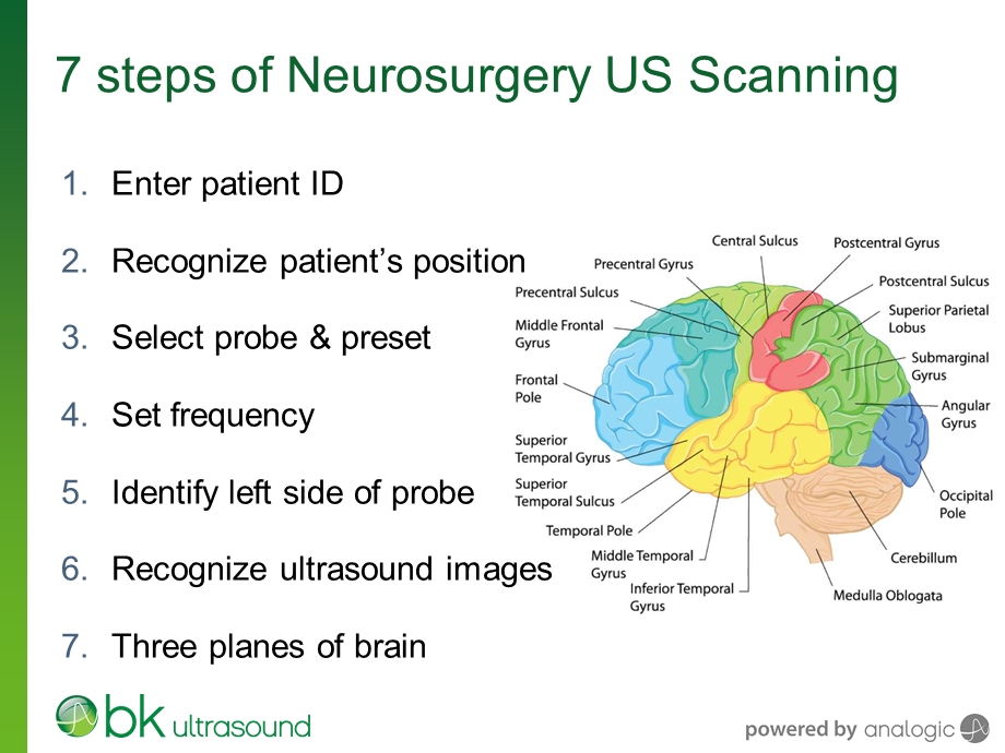 神经外科术中超声扫描七步法word版本课件.ppt_第3页