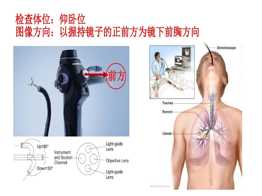 支气管分段亚段及及支气管镜检查课件.ppt_第3页