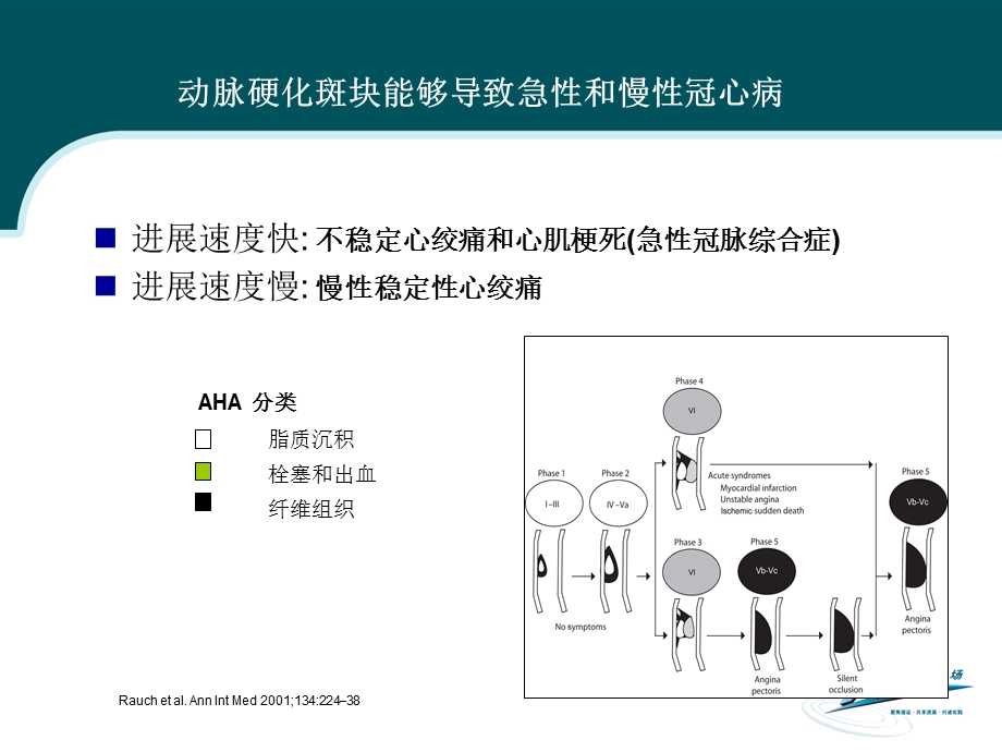 稳定型冠心病危险因素预防和管理名师编辑课件.ppt_第2页