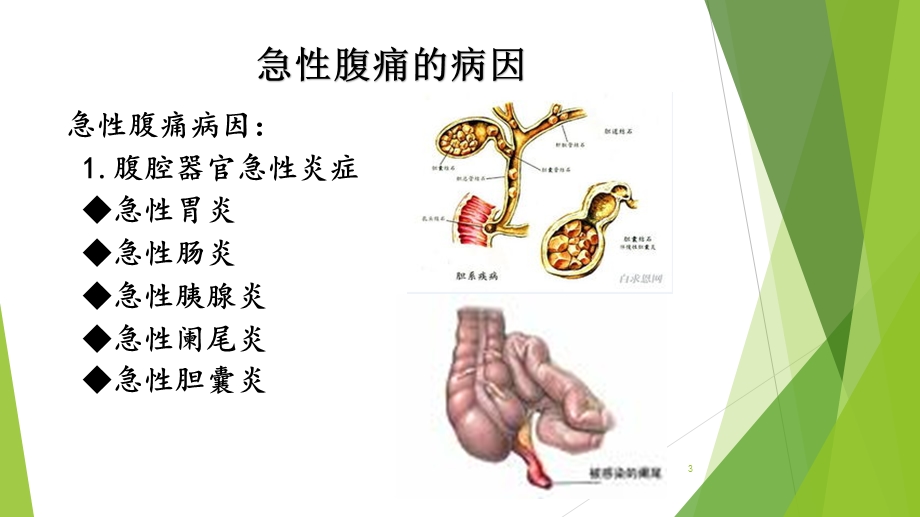 腹痛的护理参考ppt课件.ppt_第3页