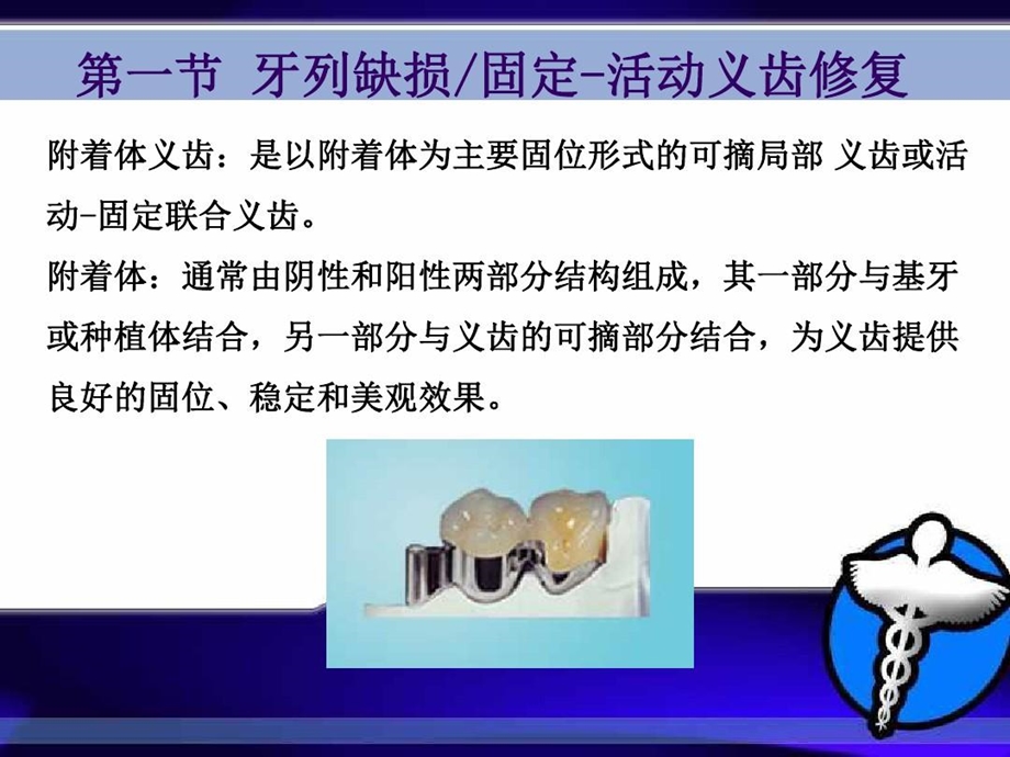 附着体可摘义齿磁性附着体义齿的制作课件.ppt_第2页