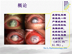 真菌性角膜炎ppt课件.pptx