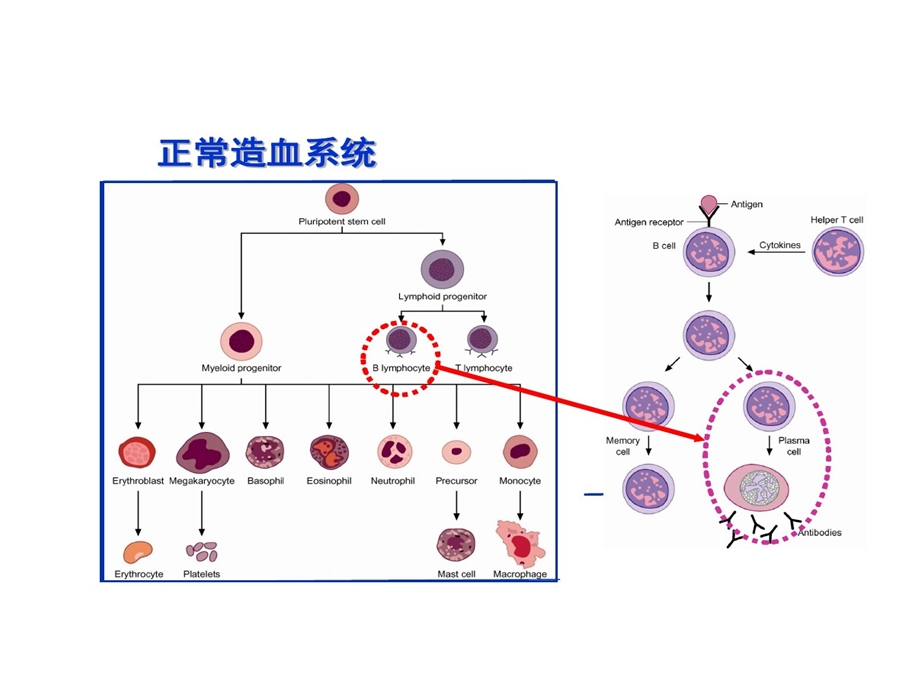 内科学多发性骨髓瘤课件.ppt_第3页