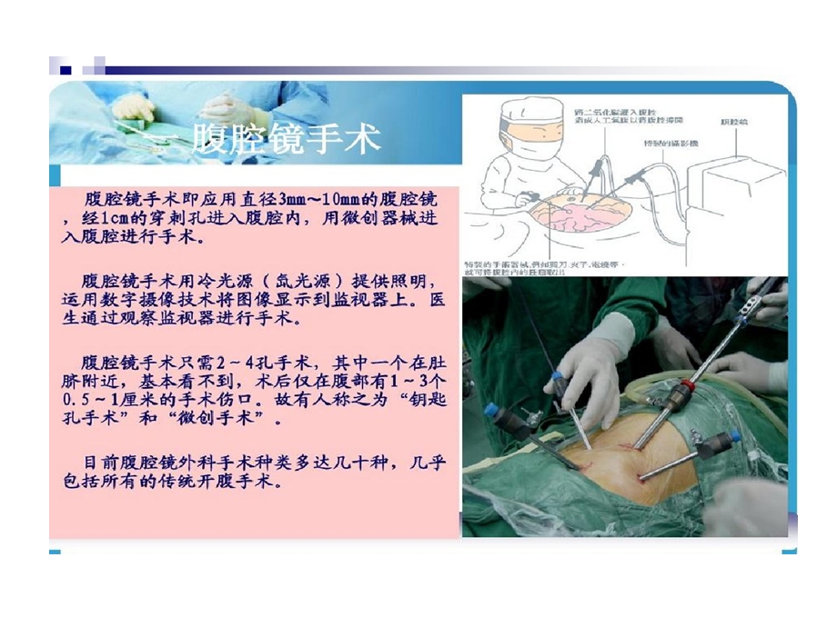 腹腔镜手术设备工作原理和操作应用课件.ppt_第2页