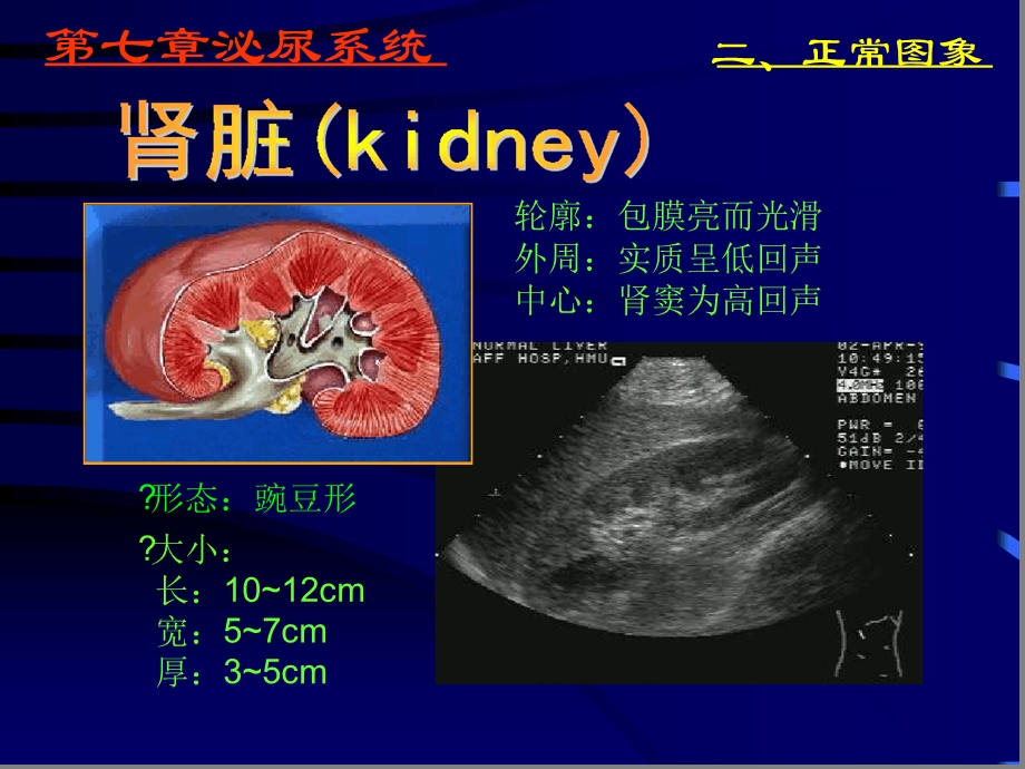 泌尿系统超声课件.ppt_第3页