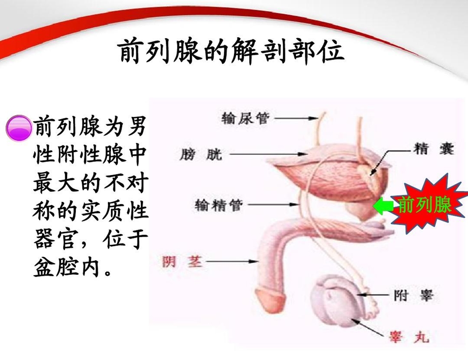 耻骨上前列腺切除术课件.ppt_第3页