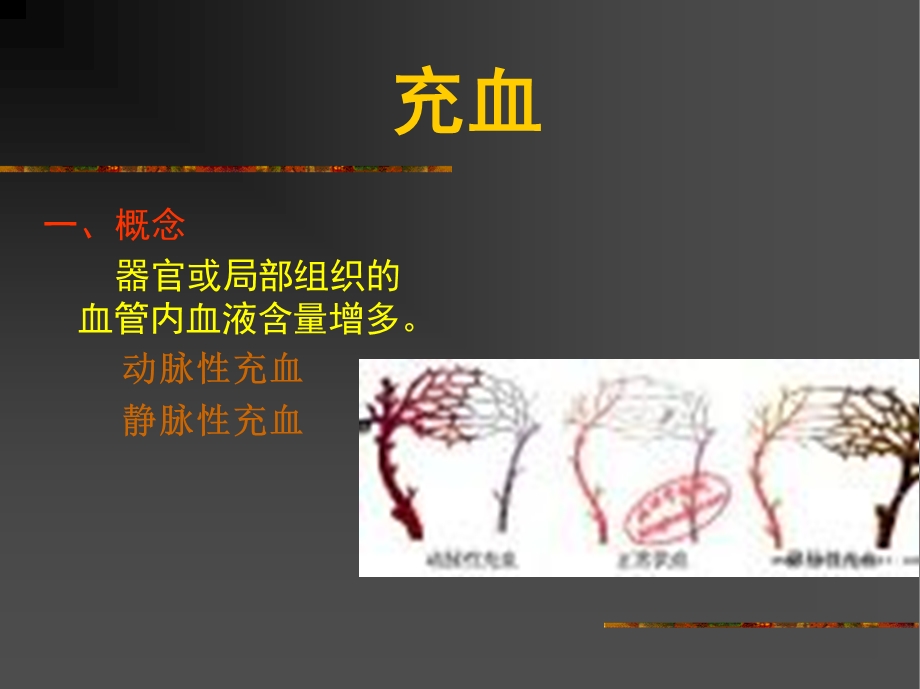 血液循环障碍的局部变化课件.ppt_第3页