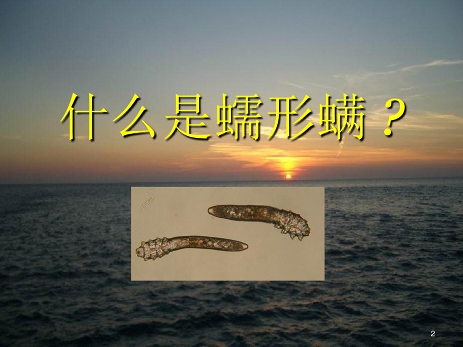 蠕形螨睑缘炎诊治的探索参考幻灯片课件.ppt_第2页