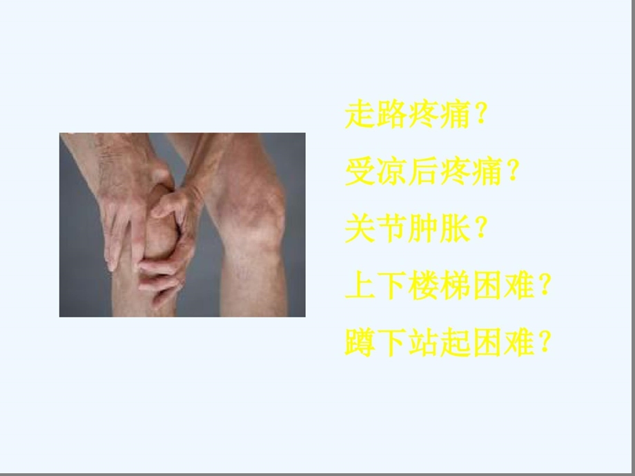 膝骨关节炎科普知识讲解课件.ppt_第2页