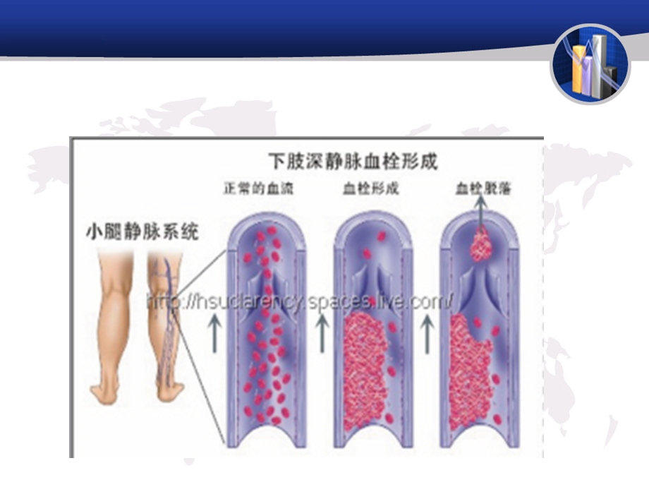 深静脉血栓形成的预防干预word版本课件.ppt_第3页