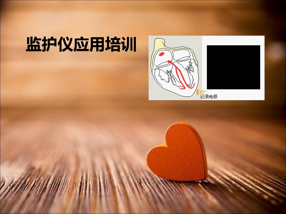 监护仪应用培训课件.ppt_第1页