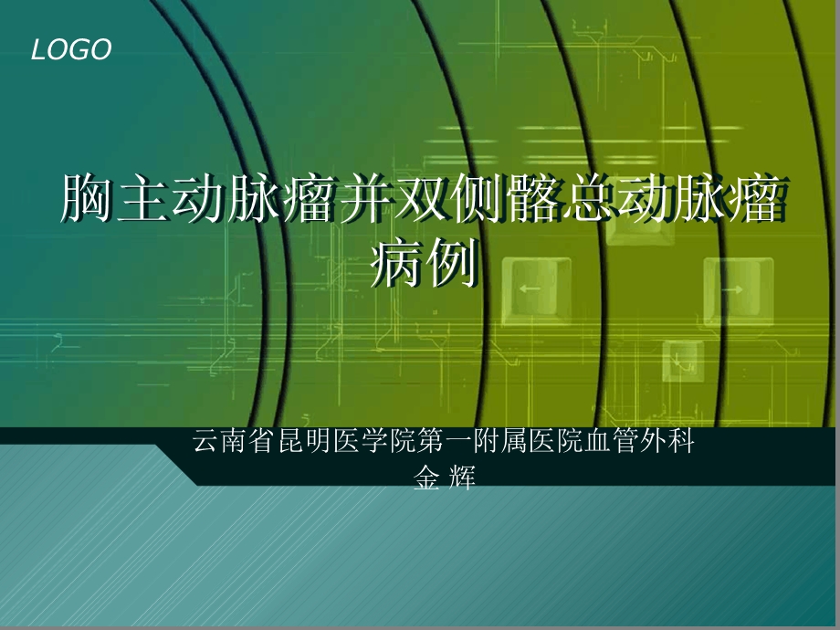 胸主动脉瘤并双侧髂总动脉瘤病例精品文档课件.ppt_第1页