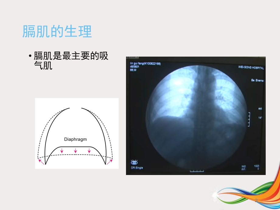 膈肌超声评估学习ppt课件.ppt_第3页