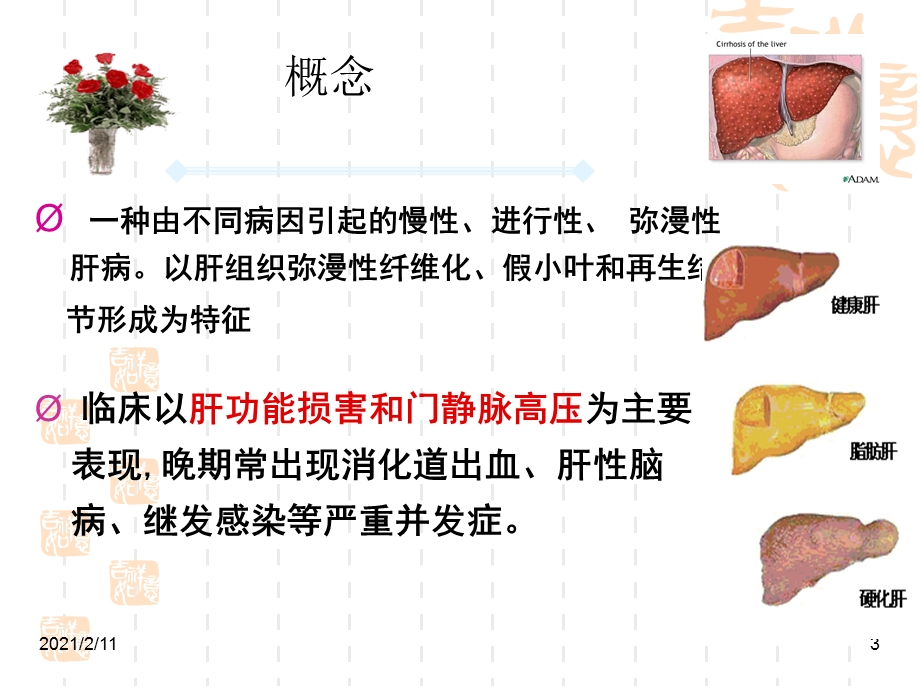 肝硬化病人的护理查房-ppt课件.ppt_第3页