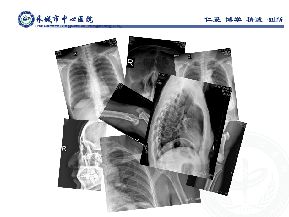 读懂X线胸部平片课件.ppt_第2页