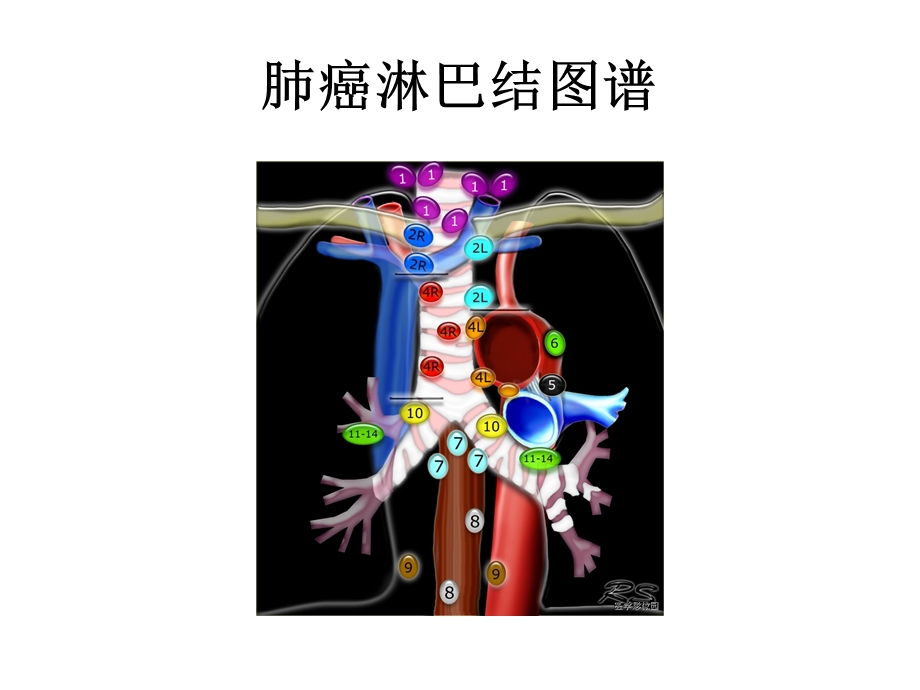 胸内淋巴结图谱ppt课件.ppt_第3页