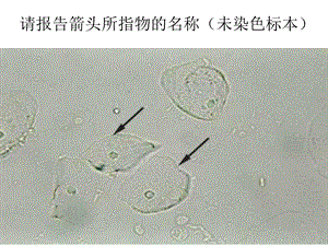 尿沉渣形态学检查室间质量评价图片精讲课件.ppt