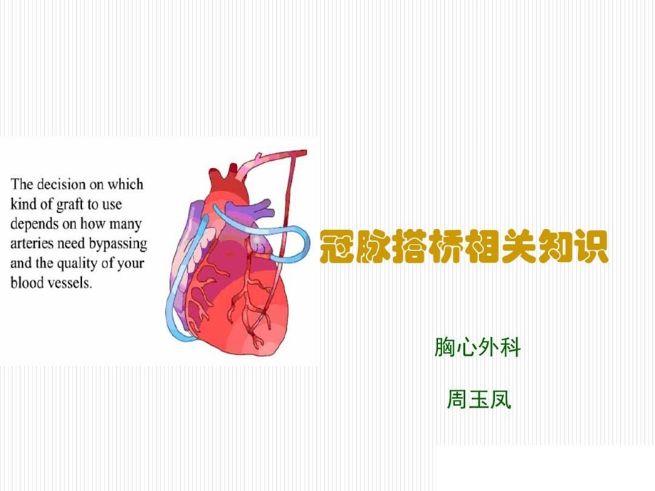 冠脉搭桥手术方式课件.ppt_第2页