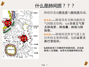 间质性肺炎ppt课件.pptx