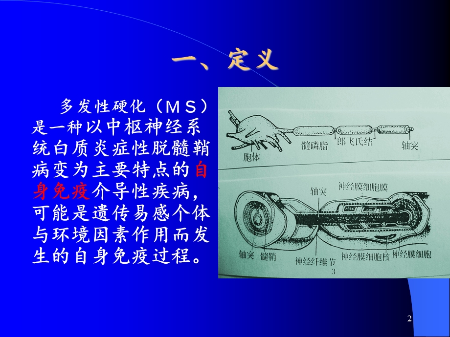 多发性硬化学习ppt课件.ppt_第2页